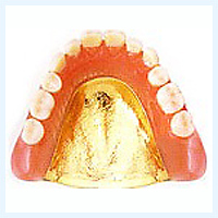 金属床義歯（自費診療）