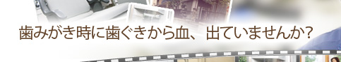 歯みがき時に歯ぐきから血、出ていませんか？